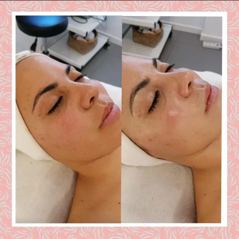 Captura De Pantalla 2021 03 29 A Las 15.59.18