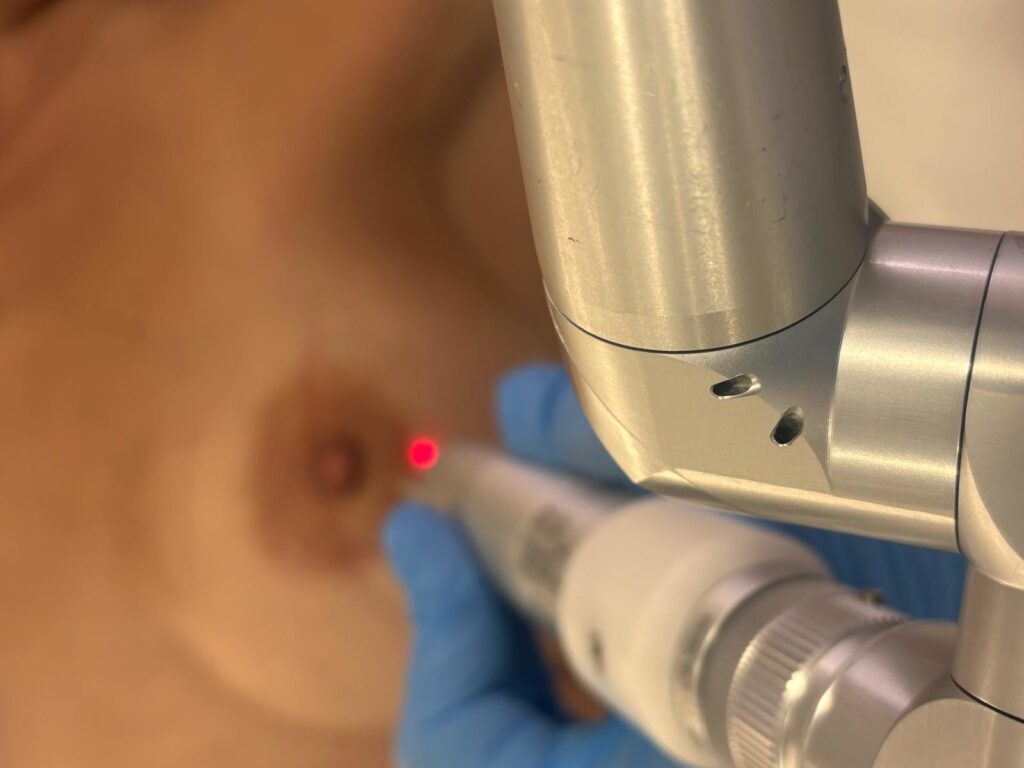 cicatrices postoperatorias