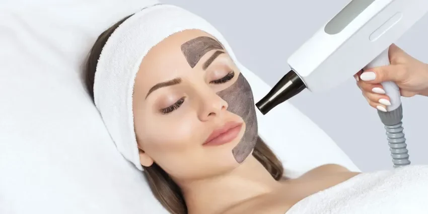 Hollywood Peel Carbon Peel 